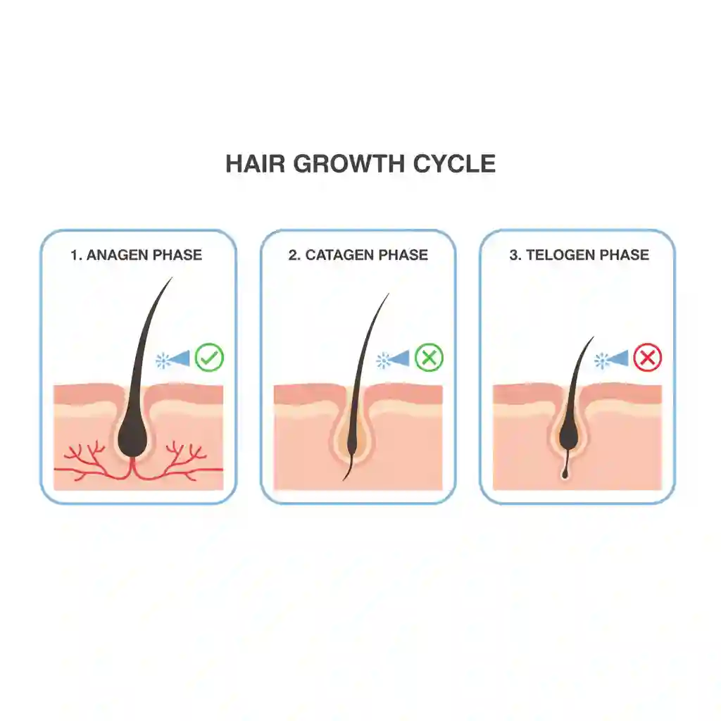 Diagram of hair growth cycle—Anagen, Catagen, Telogen—explaining why beard removal laser requires multiple sessions, targets follicles only in active growth, and delivers permanent reduction rather than instant, single-treatment elimination.