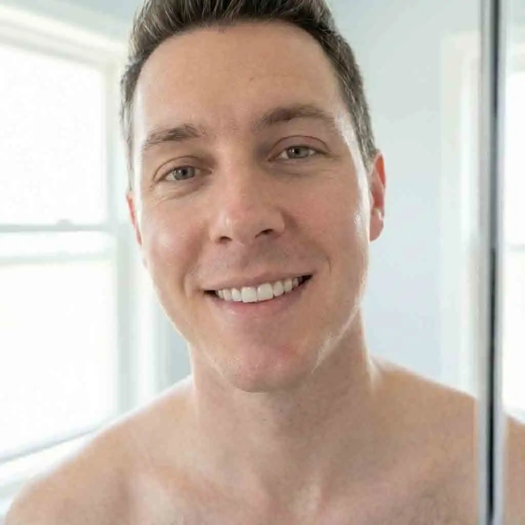 Final results after completing eight sessions of beard laser hair removal, showing over ninety percent reduction of coarse facial hair, smoother even-toned skin, and the disappearance of the persistent five o’clock shadow.