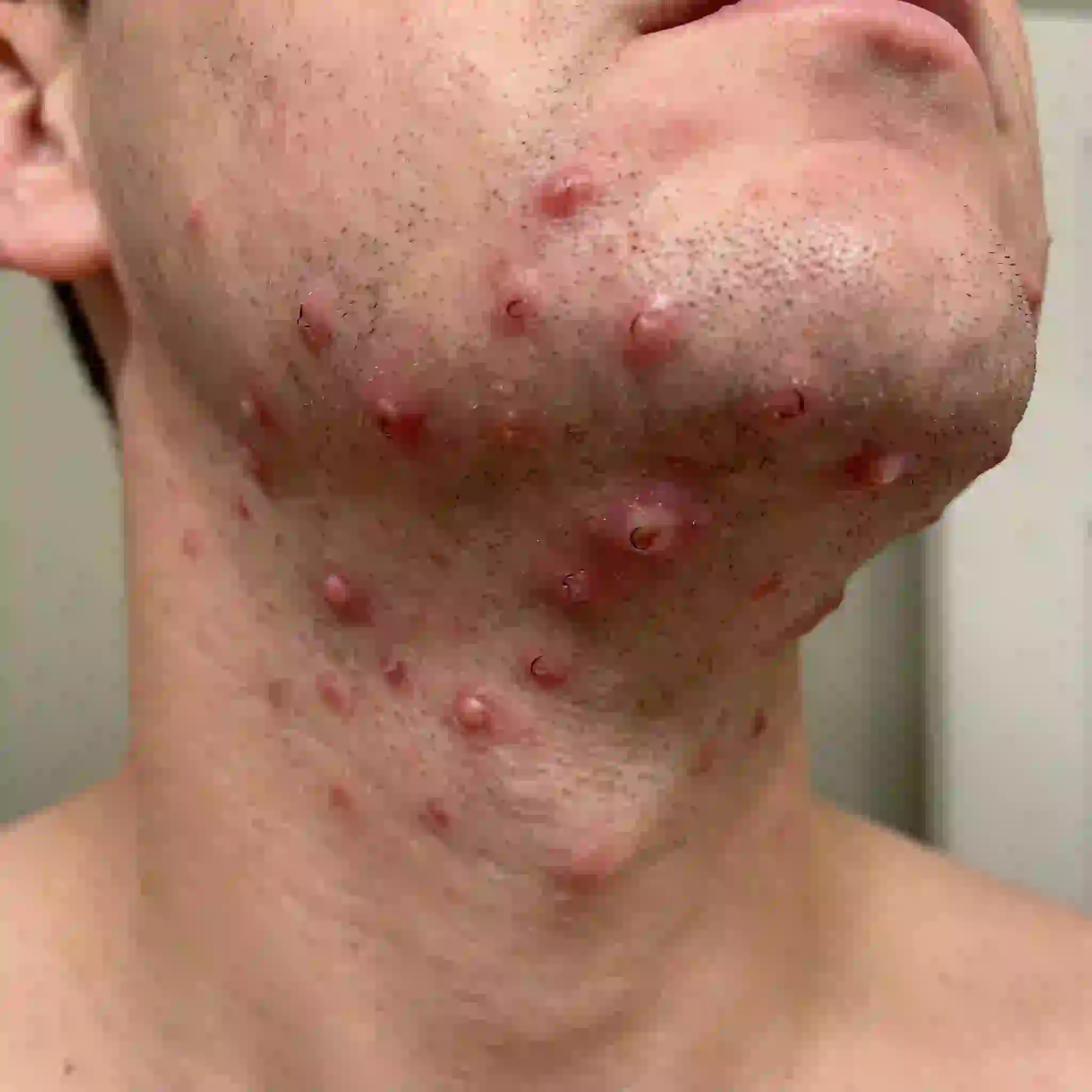 man checking skin for irritation needing best aftershave balm for sensitive skin