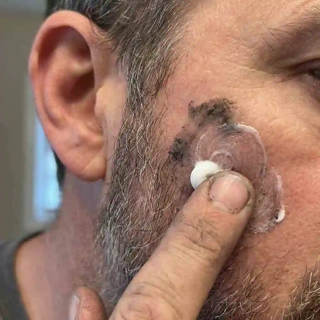 A finger applying white non-gel toothpaste to a stubborn stain on the cheek, a simple hack for how to remove beard dye from small areas.