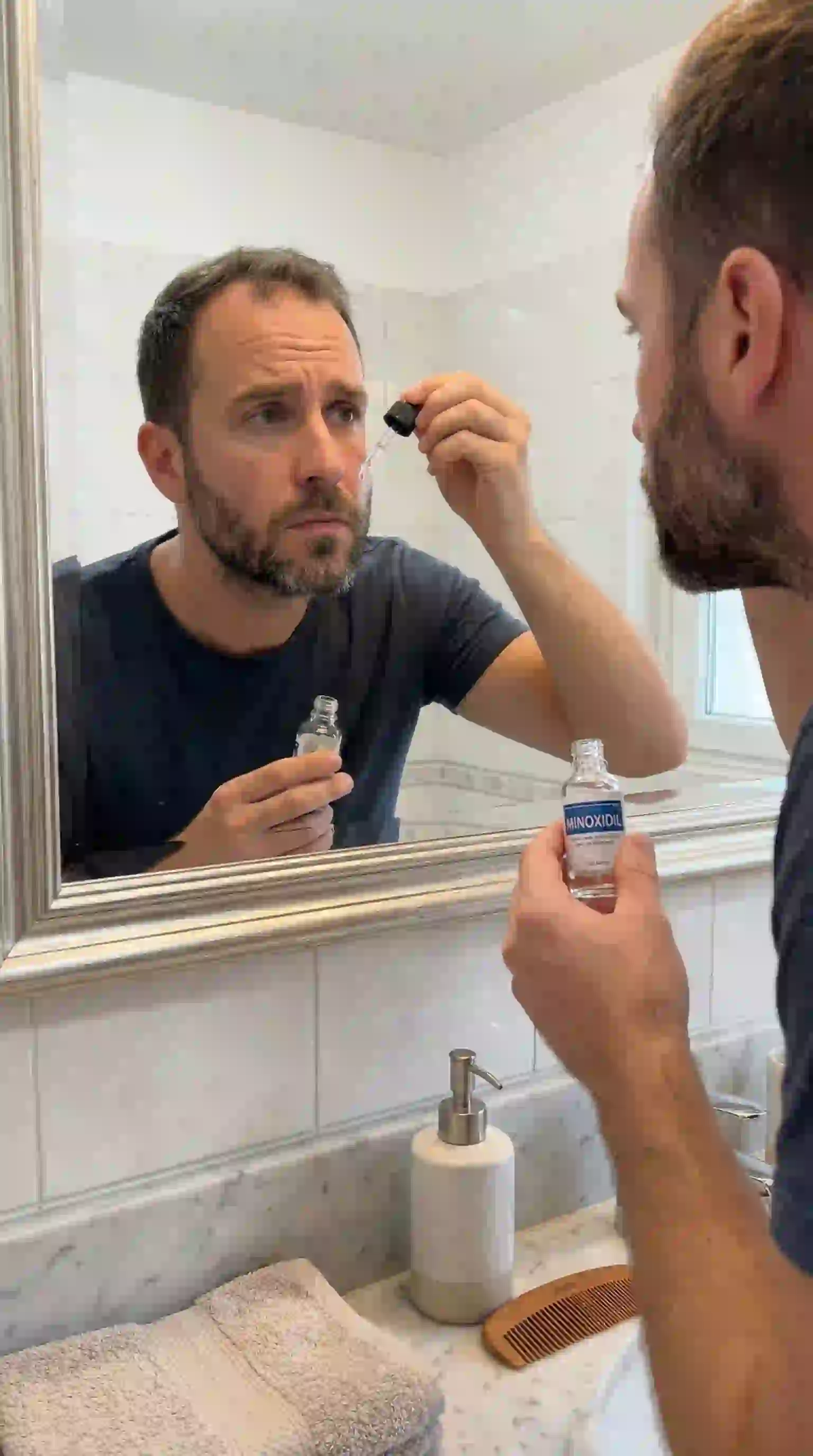 A before and after comparison showing the potential results of using Minoxidil for facial hair as a method for how to remove patchy beard.