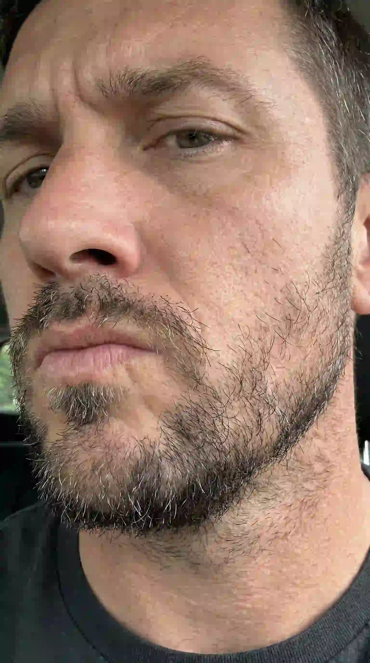 A man enduring the awkward growth phase which is a necessary step when figuring out how to remove patchy beard and let longer hairs cover gaps.