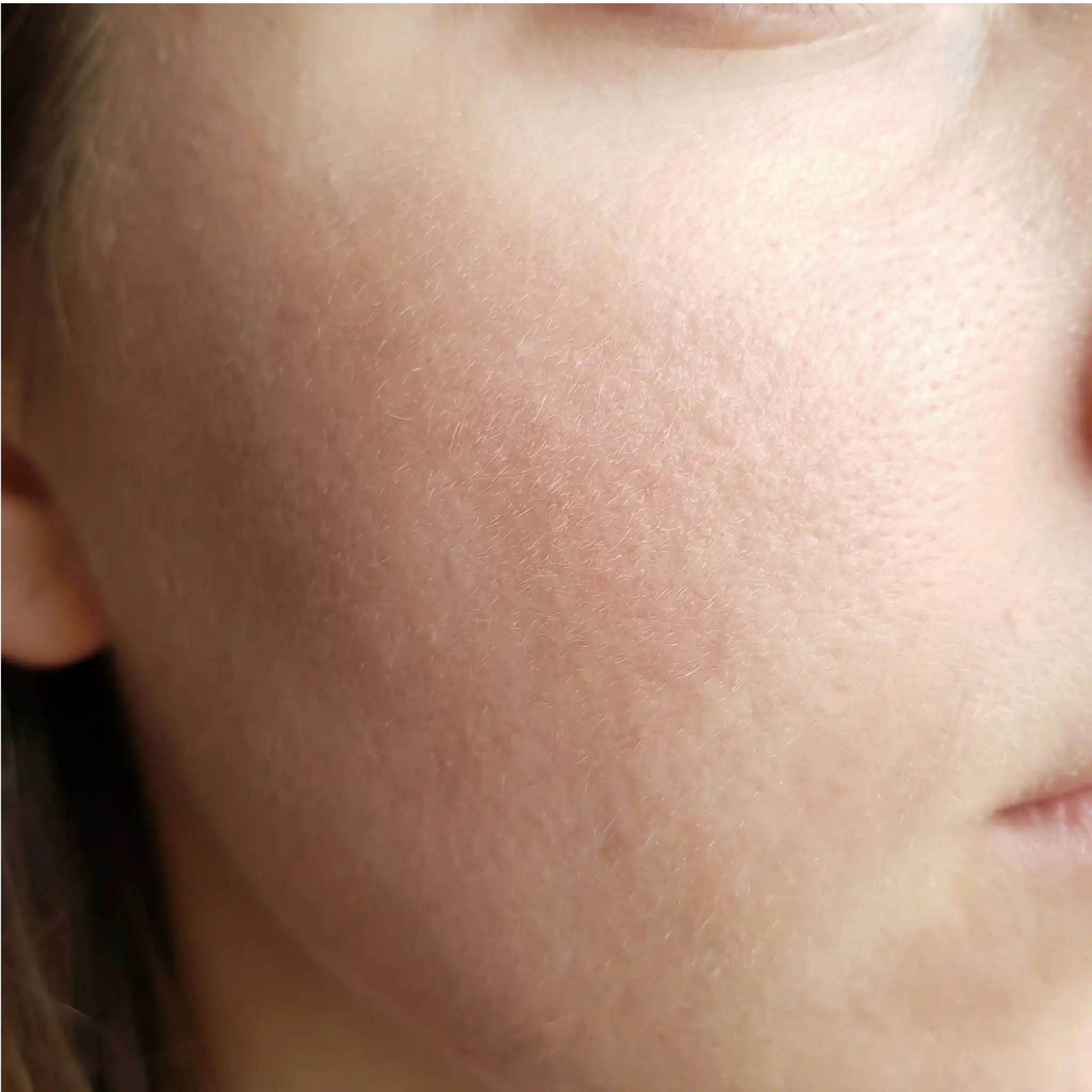 facial hair removal women explanation of fine vellus hair and peach fuzz that can affect makeup texture, skincare absorption, and facial smoothness.